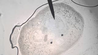 Live Fish Parasite Under a Microscope [upl. by Odie844]