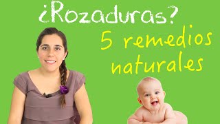 Remedios naturales para las rozaduras de tu bebé [upl. by Evan]