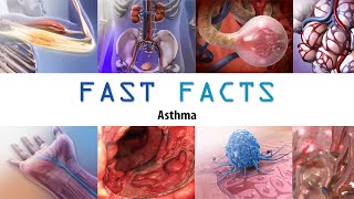 Asthma Visible Body Fast Facts [upl. by Lemyt]