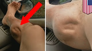 Muscle cramps explained What’s causing this guy’s leg to spasm horrifically  TomoNews [upl. by Tiedeman528]