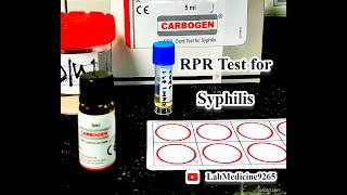 Rapid Plasma Reagin RPR Test  Serology  tulipdiagnosticspvtltdgoa [upl. by Codd]