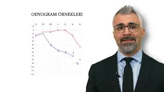 İşitme Cihazı Modeli Tercih Edilirken Dikkat Edilmesi Gerekenler [upl. by Bremen]