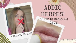 herpes addio burro cacao fai da te per prevenire e curare lherpes Aloe Ganoderma e tea tree oil🌿 [upl. by Tnecniv]