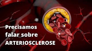 ARTERIOSCLEROSE  COMO REVERTER [upl. by Allemrac]