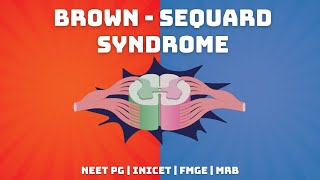 BrownSequard Syndrome  Explained in Tamil  NEET PG  INICET  FMGE  MRB [upl. by Ellesirg]