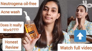 Neutrogena oilfree acne wash Honest Review  Best for oily amp Acne Prone skin not for dry skin [upl. by Kissiah]