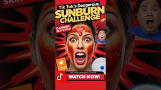 TikToks Most Dangerous Challengeshorts tiktok tiktokchallenge viraltrend skincancer health [upl. by Gregg]