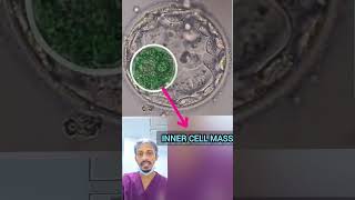 इंसान के पांच दिन का Embryo कैसा दिखता है  Have you Ever seen Day5 Human embryo [upl. by Dihsar]