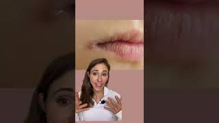 How To Get Rid Of Angular Cheilitis For Good dermatologist [upl. by Firahs422]