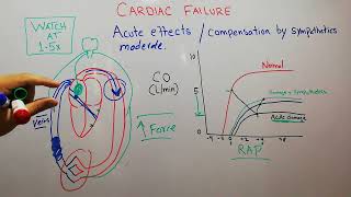 CVS 213  Acute effects of cardiac failure  sympathetic compensation of acute heart failure [upl. by Nive]