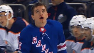 Jimmy Vesey busted open after taking Zack Kassian’s skate to face [upl. by Ynafets531]