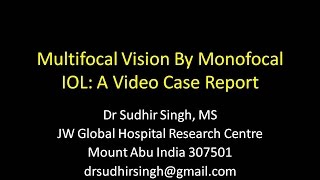 Multifocal Vision 66 N6 By Monofocal IOL  A Video Case Report [upl. by Kreiker]