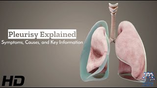 Pleurisy Unveiled Understanding Symptoms Causes and Vital Information [upl. by Meibers]