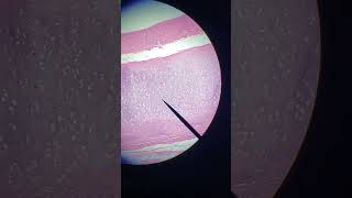 Hyaline cartilage 100x magnification [upl. by Ladnyc]