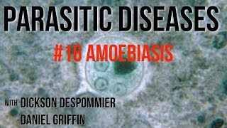 Parasitic Diseases Lectures 16 Amoebiasis [upl. by Namielus802]