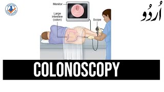 Colonoscopy Test in Urdu  What to Expect [upl. by Leanne]