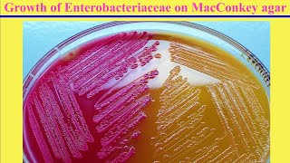 فكرة وإستخدام الماكونجى أجار Principle and Uses of MacConkey’s Agar [upl. by Jahdal]