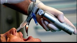 Endotracheal Tube ETT Intubation [upl. by Alegnatal914]