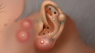 Ear Cleaning Relaxing ASMR  Animated Ear Cleaning video  Asmr For Sleeping 😴 [upl. by Tarazi]