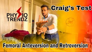 What Is Femoral Anteversion amp Retroversion and How To Test Physio trendz Physical therapy [upl. by Kenward]