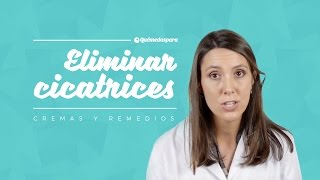 Eliminar cicatrices Cremas y remedios [upl. by Reivilo]