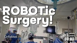 Robotic Surgery Surgeons Perspective [upl. by Linus]