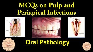 MCQs in Oral Pathology  Pulp and Periapical Infections [upl. by Assilem]