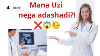 MANA NIMA UCHUN UZI HOMILA JINSINI XATO AYTADI😨😱😱😱❌❌❌❌❌❌❌❌ BUNI BILISHINGIZ SHART🔥💯🆘🆘🆘🆘✅✅✅ [upl. by Nojram]