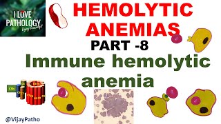 Hemolytic Anemias Part 8 Immune Hemolytic Anemia IHA [upl. by Darwin606]