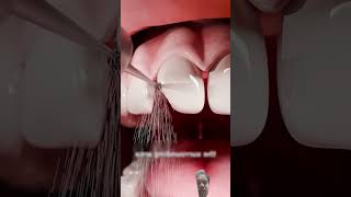 Dant kaise theek Karen knowledge amazingfacts dentist interestingfacts education [upl. by Eentihw]