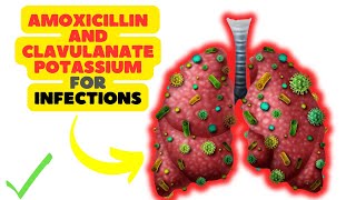 Amoxicillin and Clavulanate Potassium A DualAction Antibiotic for Bacterial Infections [upl. by Allenrad565]