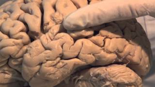 Introduction Neuroanatomy Video Lab  Brain Dissections [upl. by Zoarah]