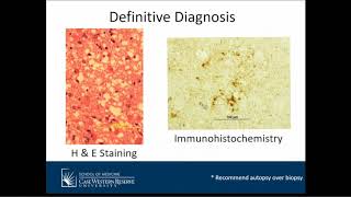 CreutzfeldtJakob Disease and Other Prion Diseases [upl. by Aivlis]