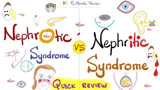 Nephrotic AND Nephritic Syndrome  Quick Review  Nephrology amp Pathology [upl. by Fanchette64]