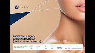 BIOFILS®  BIOESTIMULAÇÃO LATERAL DA BOCA Linha de marionete [upl. by Finnigan]