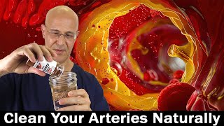 A Splash of Spice in WaterCleans Arteries Lowers High Blood Pressure amp Cholesterol  Dr Mandell [upl. by Einnaf]