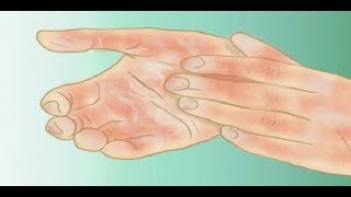 Voici pourquoi vous avez les mains et les pieds froids et comment y remédier [upl. by Natty831]