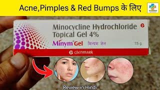 Minym Gel Review in Hindi  Minocyclic Gel How to Use  Acne Pimples amp Red Bumps  SK MEDICINE [upl. by Terrilyn131]