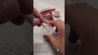 Polymer Beads Temporary Teeth DIY [upl. by Nylrahs]