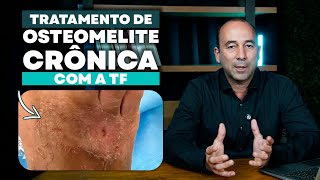 Tratamento de Osteomielite crônica com a TF [upl. by Meehar]