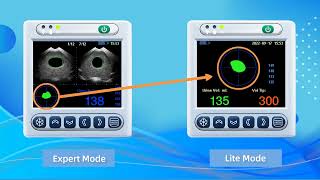 Bladder scanner BVT02 Introduction [upl. by Chuah]