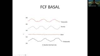 Monitoreo fetal [upl. by Darrell]