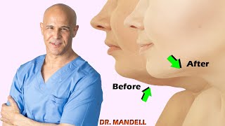 Simple Jawline Exercises to Remove Double Chin  Dr Alan Mandell DC [upl. by Elyad]