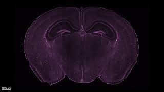 Mouse brain cleared with CUBIC [upl. by Zuckerman]