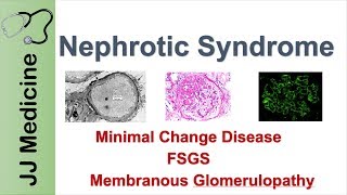 Nephrotic Syndrome  Clinical Presentation Causes and Treatment [upl. by Annair]