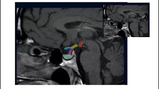 The Pituitary Gland ANATOMY  crisp  basics  imaging  approach  ELSTER’S rule [upl. by Uhn168]