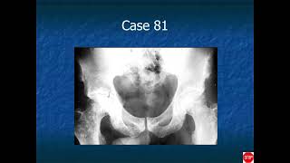 RADIOLOGY EXAM CASES [upl. by Adala]