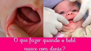 O que fazer quando o Bebê nasce com dente [upl. by Eelirak]