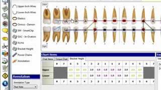 Dolphin Management Tooth Chart Overview [upl. by Eveivenej555]