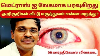 madras eye treatment symptoms home remedies in tamil   dr karthikeyan [upl. by Ainerbas]